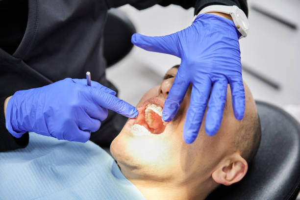 Best After-Hours Emergency Dentist in Holly Lake Ranch, TX
